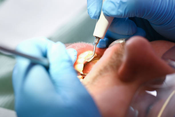 Best Urgent Care for Lost Fillings or Crowns in Bethel Acres, OK