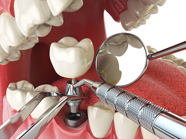Best Urgent Care for Lost Fillings or Crowns in Bethel Acres, OK